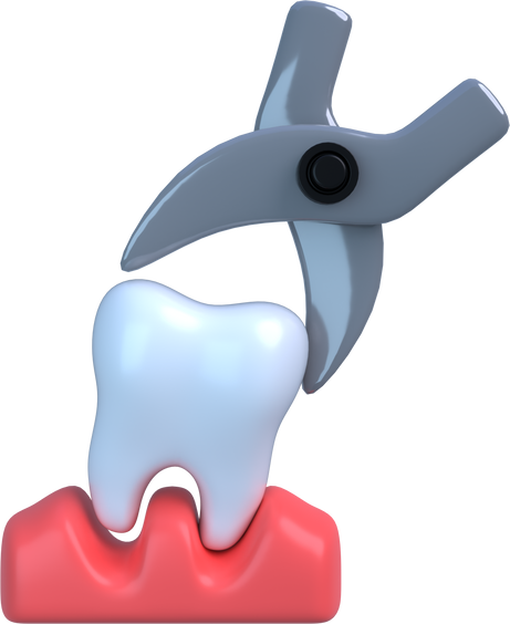 3D Tooth Extraction Illustration